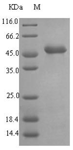 Recombinant Pseudomonas aeruginosa Elastase (lasB) - 100 µg
